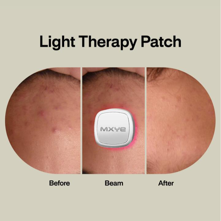 Acne Light Therapy Patch- 6 Pack